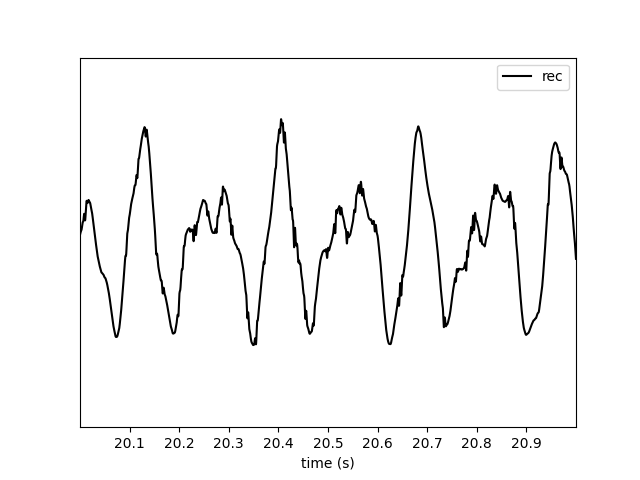 Extract LFPs — SpikeInterface documentation
